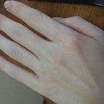 <b>사진</b>有))여성분들 손가락?여기 <b>털</b>이 나는데 이상한가요??