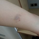 기숙사 이용하시는 대학생 분들 이런 경우 있으신가요?
