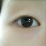 쌍수해야할까요...ㅠㅠ