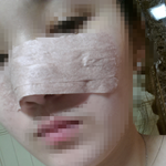 얼굴8<b>바늘</b>꼬메고도가해자가됫습니다