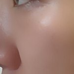 <b>코끝</b>에 연골이 아예없는 것 같아요..