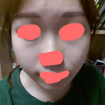 여드름은없는데 피부에 이런거뭐에요???ㅜㅜㅜ