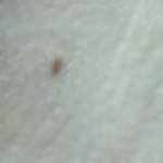 겨드랑이에난거이거뭐에요?ㅠㅠ