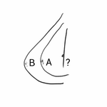 가슴이 작아도 너무작아 고민이에요