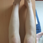허벅지 위부터 급격히 굵어지는 나의 다리ㅜㅜ