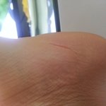 발바닥에있는이거<b>주름</b>인가요?ㅠㅠ