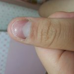 이<b>손톱</b>평생이쁘게못되나여??