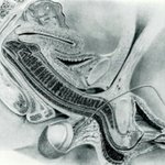 <b>mri</b> 판독해라