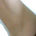 (사진有) 겨털<b>자국</b>ㅠㅠ 도와주세요!