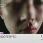 (사진有) 오늘 렛미인3 진짜 안타깝네요.. 화장성형녀/<b>반쪽</b>얼굴