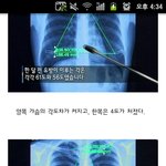 가슴이 많이 커서 노브라로 있으면 쳐지는거 같은데 어떡하죠
