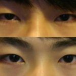 남자들 <b>속</b><b>쌍</b>수술 개많이하는뎈ㅋㅋㅋ