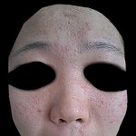 피부트러블 관련 (+ 혐짤 주의하세요)