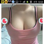 -----후기----- 가슴수술