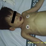 <b>울산</b> 어린이집 폭행 사망사건
