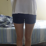 진짜열심히뺀<b>다리살</b>좀봐주세요그만뺄까요ㅠㅠ