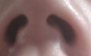 콧구멍판 유행시켜보자