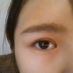 오늘<b>쌍수</b>하고왔어요~ 사진있어요!