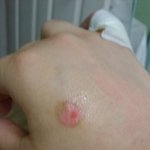 고깃집에서 저에게 화상을 입혔는데 오히려 협박을 하며 <b>보상</b>을 안해줍니다.