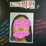 코 성형수술 마루타? <b>재판</b>중이에요
