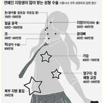 [EXO] 연예인 <b>지망</b>생이 가장많이 받는 성형