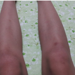 <b>김치</b><b>년</b>니 다리평가