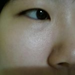 혐) <b>눈</b> <b>밑</b>에 이거 어떻게 없애나요?