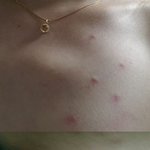 맥<b>xxx</b> 식중독 피해사례를 신고,고발합니다.