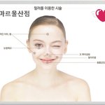 <b>필러</b>시술 받았네요.