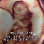 임신 16주째입니다 이게 정상인가요?