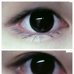 [글내림____]사진)<b>무쌍</b>큰눈 쌍수할까요????ㅠㅠ