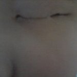 (후기)ㅋㅋㅋ쌍액부작용ㅋㅋㅋ