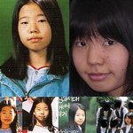 <b>써니</b> 성형전