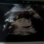 <b>손발</b> 부어서병원 갔는데요 성별과2차검사 하고옴