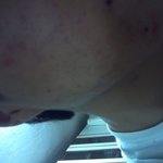 +추가)피부는 긍정,<b>생활패턴</b>,식습관이면됩니다.