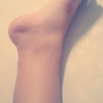 <b>발목</b>나보다 두꺼운사람있어요?