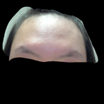 <b>이마</b>가너무넓어서 스트레스입니다