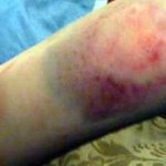 [억울해요] 남친한테 폭행당하고 걸레란 욕 들었어요.