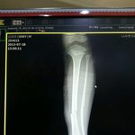 <b>법률자문</b>) 개념없는 '키즈파크' 고소하고싶습니다.