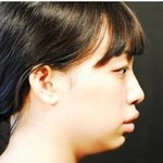 렛미인 최강<b>반전</b>녀