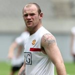 <b>모발</b> 이식했던 루니 최근