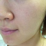 [여드름] 최악의 피부를 갖고 있는 제가 알려드리는 피부 관련 꿀팁들...