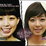 렛미인 3대 러블리 미녀들