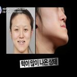 렛미인 최고변신 성공한 베이비페이스 13대 주인공!