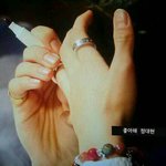 [BAP] 정대현손가락다쳤어?
