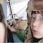 수지 <b>쌍</b>커플수술