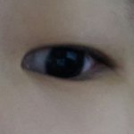 [도와주세요] 고등학생 <b>쌍수</b>