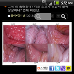 [여자의심리] 일베 식 표현의 자유