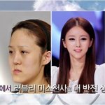 렛미인3 가장 예뻐진 순위??