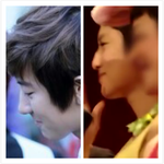 [EXO] <b>찬열</b>이 코수술했네